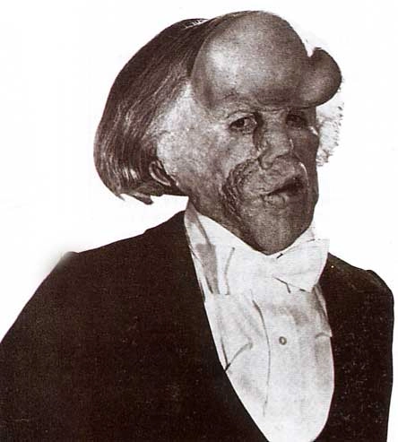 ElephantMan